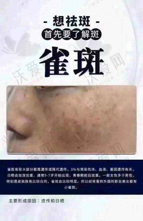 成都友谊整形激光祛雀斑的术后注意事项有哪些？