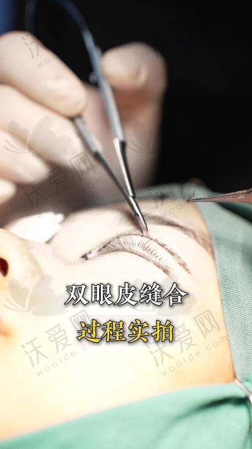 总结——深圳丽港丽格医疗美容医院吕晓伟医生怎么样？