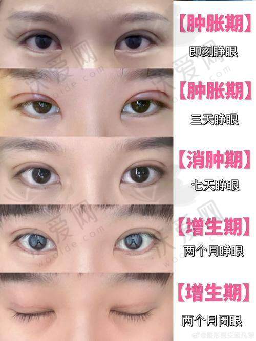 深圳丽港丽格医疗美容医院吕晓伟医生技术好不好？