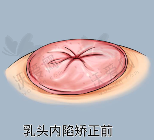 诸暨西子医疗美容医院医生名单及简介