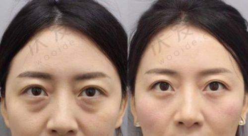 总结——上海诺诗雅医疗美容医院花金环医生怎么样？
