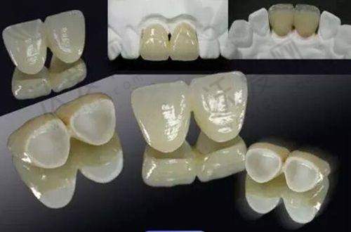 泰康拜博口腔技术怎么样？