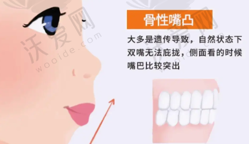 长春牙冠军口腔医院技术实力如何？数字化诊疗显身手
