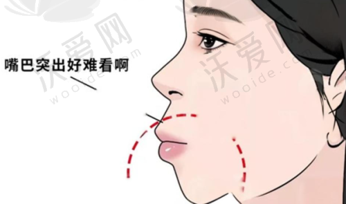 泰康拜博口腔是否为正规医院？补贴、技术、价格全正规安心看牙选它！
