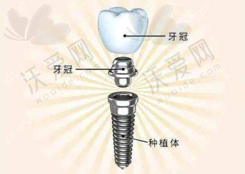 咸阳瑞超口腔：注重健康与美容结合的口腔医院
