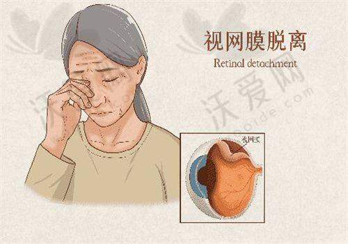 重庆佰视佳眼科医院实力如何？