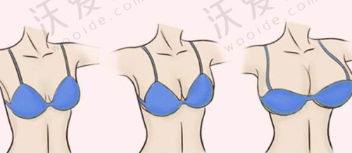 上海诺诗雅医疗美容医院花金环医生挂号预约攻略