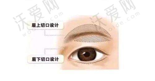 六盘水利美康整形光子嫩肤，个性化诊疗放大成果