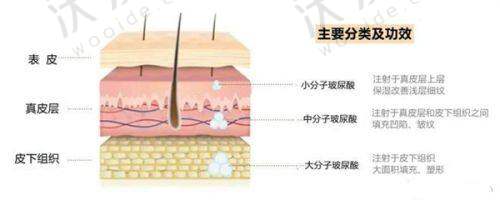 温州艺星医疗美容医院口碑如何？