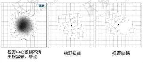 重庆佰视佳眼科医院张哲豪医生介绍