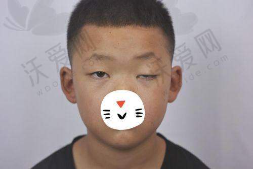 除了上睑松弛矫正项目，上海爱尚丽格医疗美容还有其他一些眼部整形项目，以下是部分项目的价格参考（因个人方案差异仅供参考）：-双眼皮手术：3800元起-开眼角手术：4500元起-去眼袋手术：5000元起