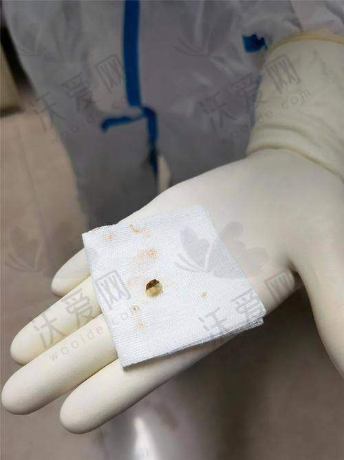 北京煤医医疗美容医院：鼻部异物取出佼佼者