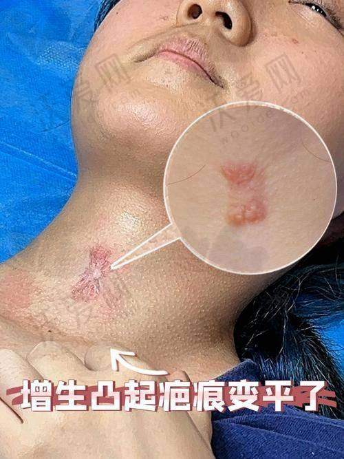 上海虹桥医院疤痕科修复增生疤痕之医院整体优势