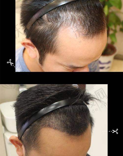 成都丝恒植发——技术娴熟口碑良好的后起之秀