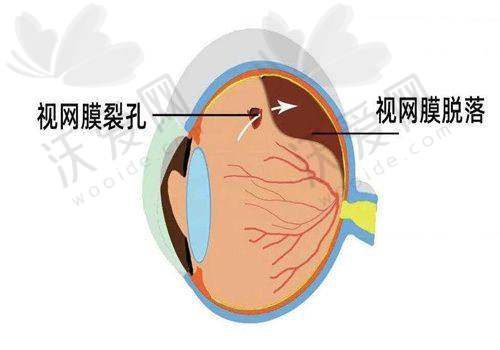 郑州大学第一附属医院眼科到院预约挂号