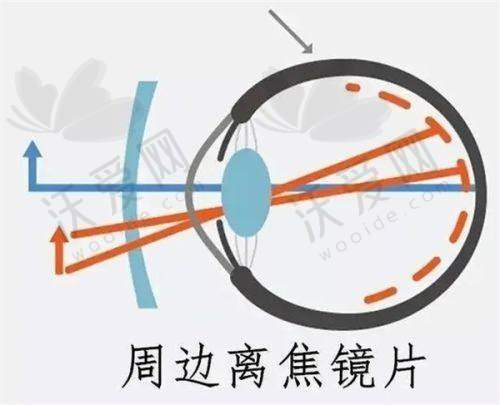 郑州视光眼科医院成人医学验光套餐原价280元现38元起，连锁大医院别错过！