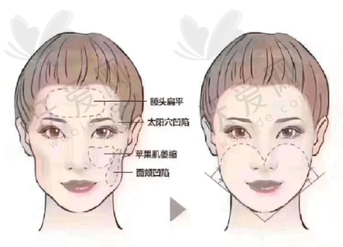 芜湖壹加壹医疗美容门诊部口碑如何？