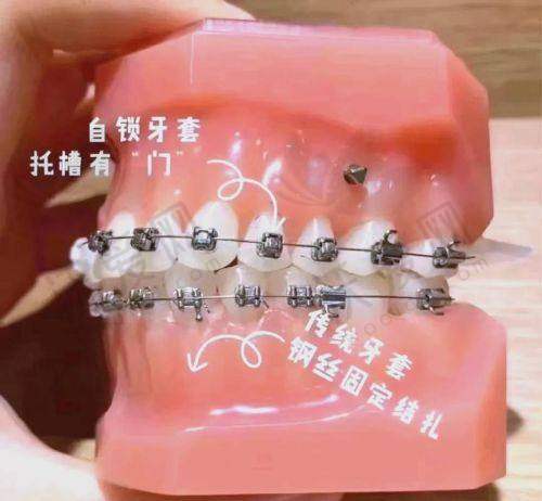 湛江柏乐口腔段婷医生水平如何？