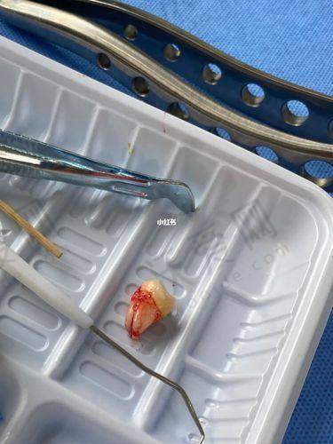 湛江柏乐口腔医院还有其他口腔项目吗，价格怎样呢？