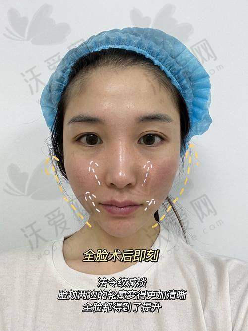 成都素美医疗美容热拉提PLUS全模式原价480元现456元起，舒适体验别错过!