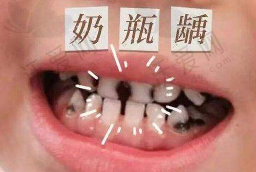 南昌摩尔口腔医院患者口碑怎么样？
