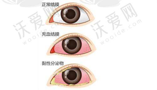 昆明艾维眼科是一家怎样的医院？