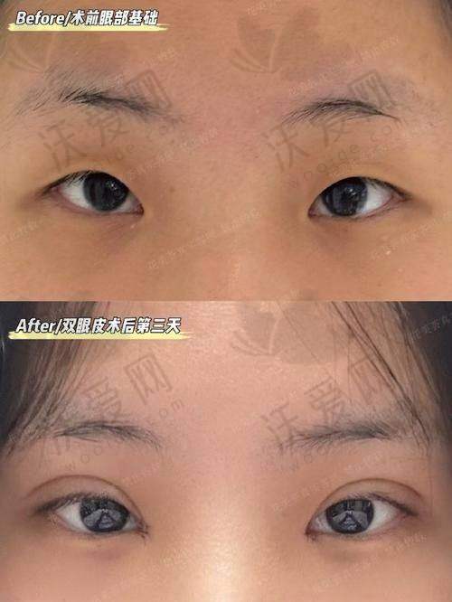 上海薇琳医疗美容医院杨荣华医生挂号预约攻略