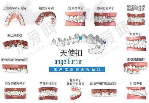 徐州美奥口腔其他口腔项目收费标准参考