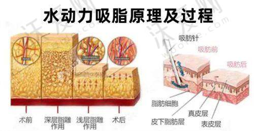 哈尔滨蜜柚医疗美容医院汪奇志医生口碑评价如何？