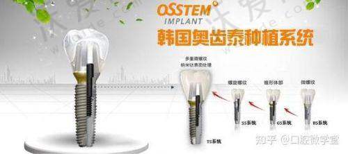 哈尔滨中航口腔奥齿泰种植牙医生团队实力雄厚