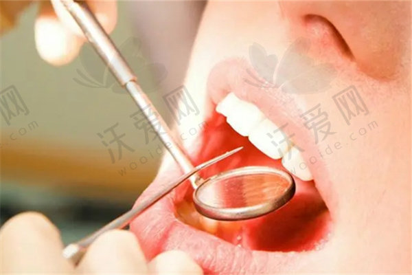 成都医大口腔医院智齿发炎冠周冲洗80元起，清洁消炎又舒适还能个性化治疗！