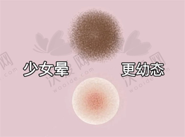 武汉真爱妇产私密修复医院王艺洁乳晕漂红490元起一次，激光焕粉乳晕开启少女粉嫩梦！