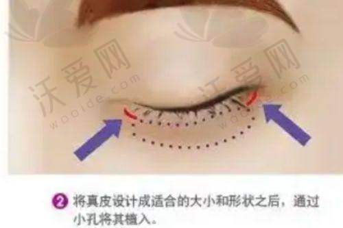 洛阳西工区毛大夫医疗美容门诊部技术好不好？