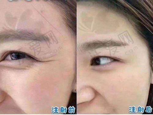 成都素美不是渠道医院