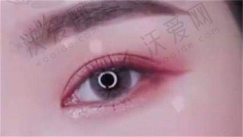 云南省昆明韩辰医疗美容医院杨瑞年医生技术好不好？