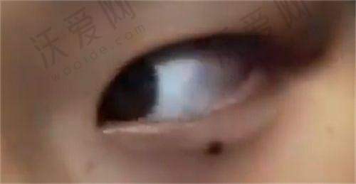 南宁柏琳悦美医疗美容医院医生名单及简介