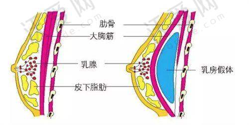 广东深圳艺星医疗美容医院黄海侠医生口碑评价如何？