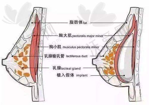 云南昆明韩辰医疗美容医院王德宁医生口碑评价如何？