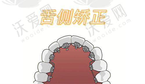 长沙赛德阳光口腔医院正畸情况