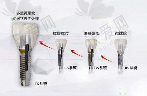 深圳观澜种植牙/矫正排名前三牙科揭秘：诺德、青柠檬、贝尔各有千秋