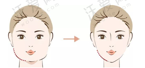 南宁柏琳悦美医疗美容医院地址