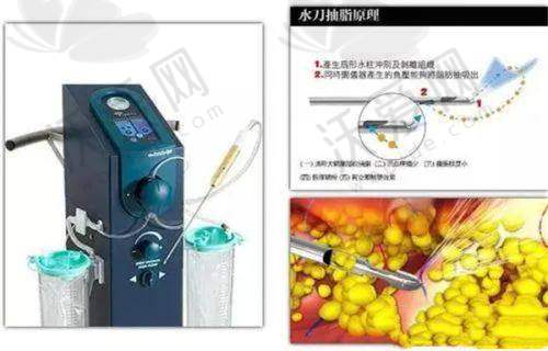 深圳艺星医疗美容医院徐英医生挂号预约攻略
