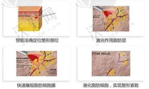 总结评价——平顶山市花熙医疗美容门诊部怎么样？