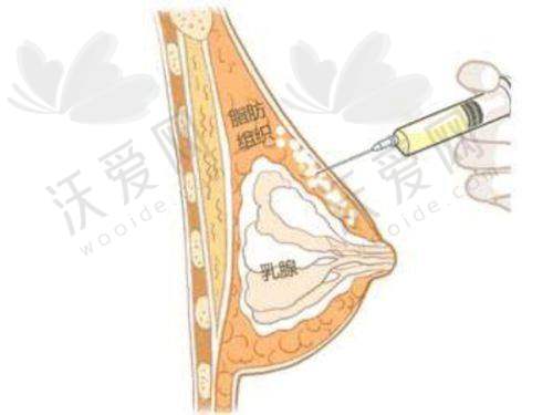 总结评价——南宁柏琳悦美医疗美容医院怎么样？