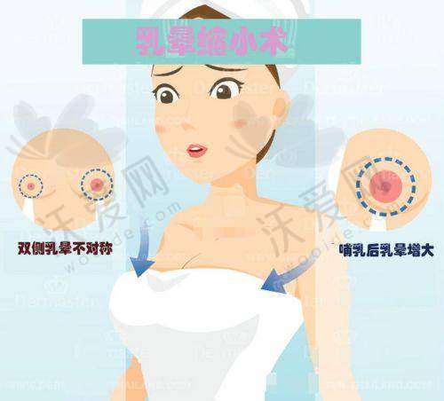 武汉真爱妇产私密修复医院有擅长乳头+乳晕漂红的医生吗？