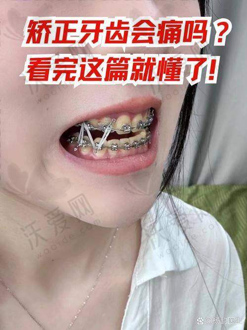 广州曙光口腔正畸实力与特色