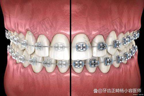 广州圣贝口腔正畸实力与特色