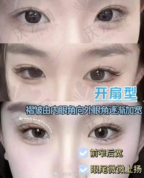 杭州美莱医疗美容医院孟晨曦技术好不好？