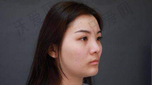 浙江杭州美莱医疗美容医院胡斌医生口碑评价如何？