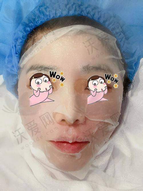 大连沙医生皮秒激光+M22超光子全模式的神奇作用